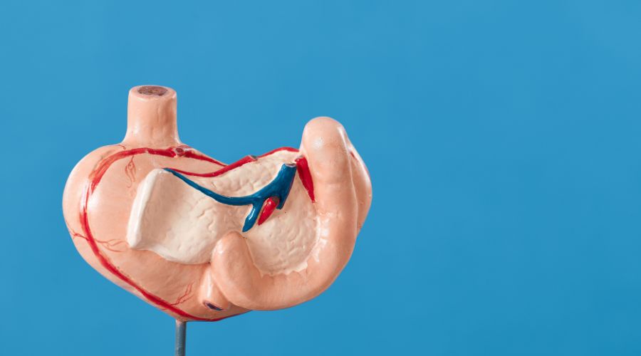 Mengenal Batu Ginjal : Penyebab, Gejala Dan Cara Mencegahnya